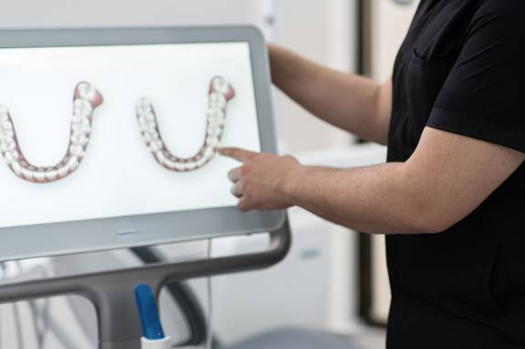 Zahnarzt erklärt 3D-Scan auf einem Monitor