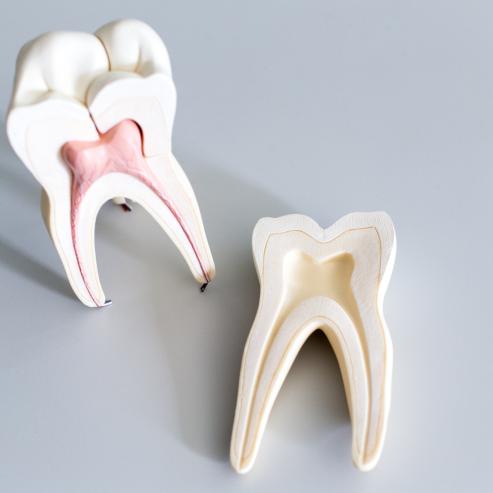 Geöffnetes Zahnmodell, bei dem man die Zahnwurzel sieht