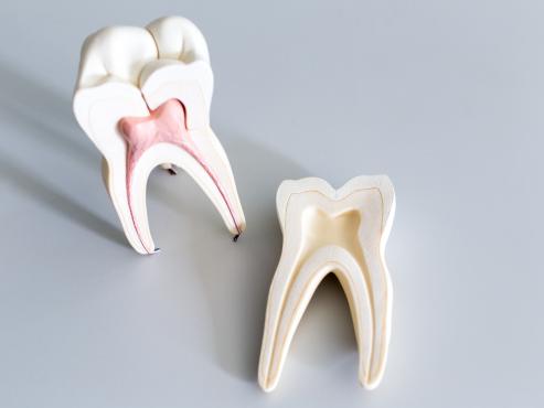 Geöffnetes Zahnmodell, bei dem man die Zahnwurzel sieht