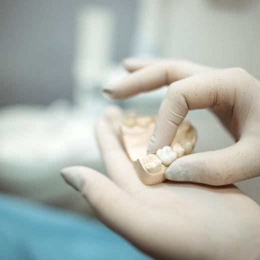 Zahnlaborant hält Gibsmodell eines Kiefers