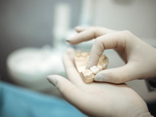 Zahnlaborant hält Gibsmodell eines Kiefers